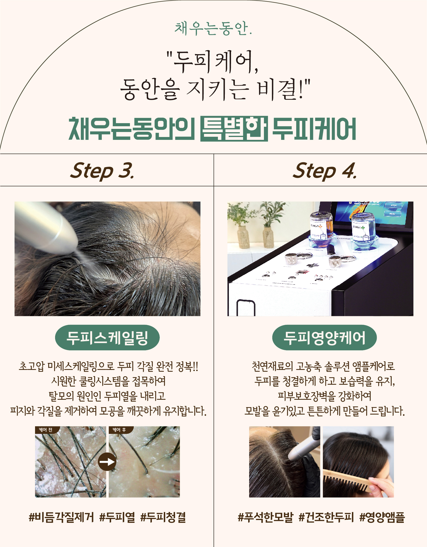 채우는동안 대표 이미지