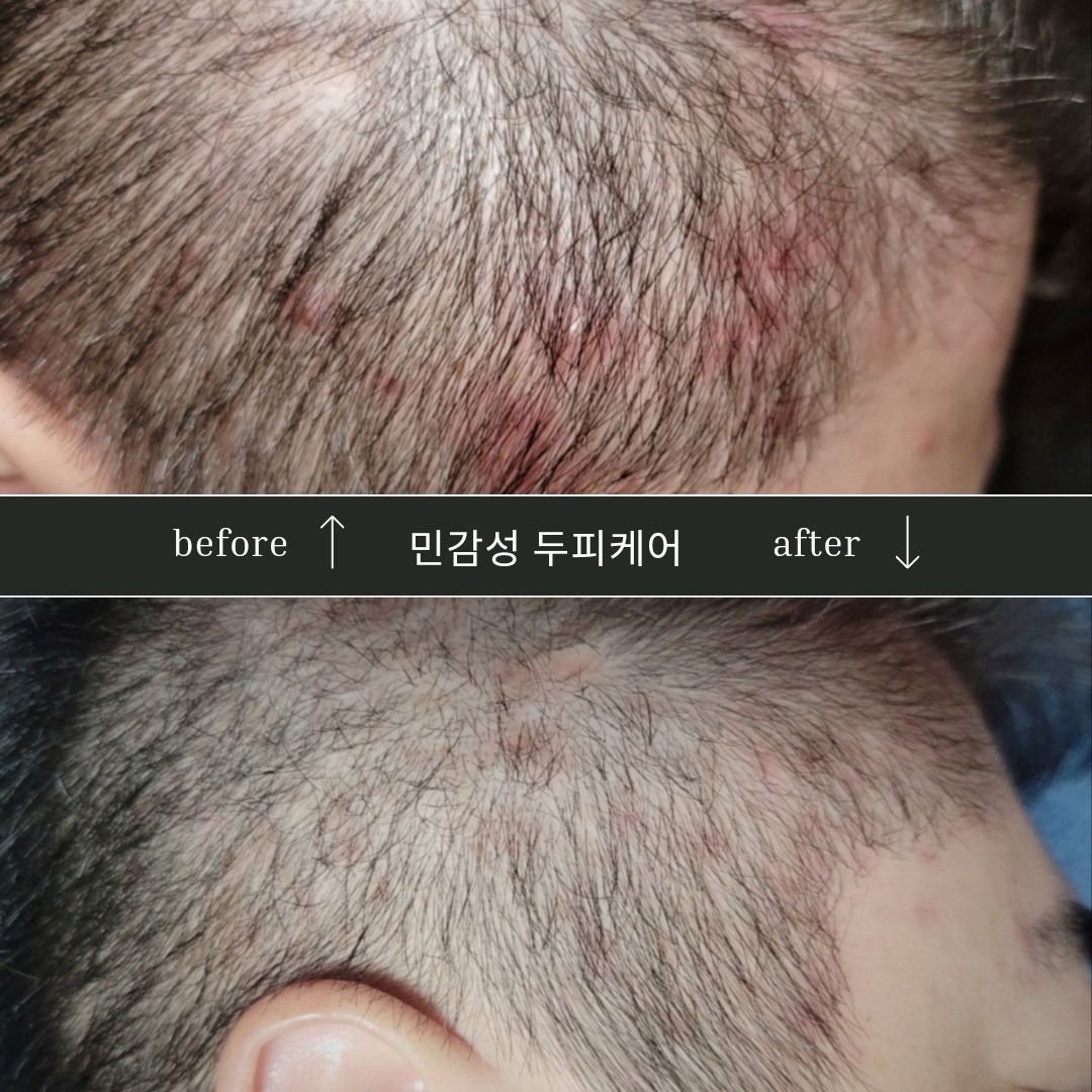 더블라인스칼프 제주점 photo 7