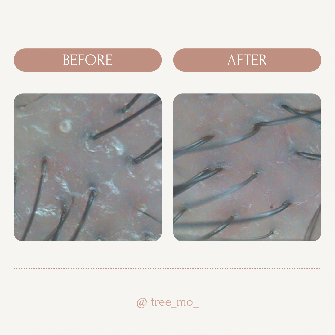 트리모 본점 대표 이미지