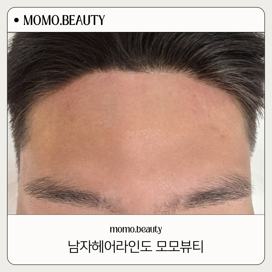 모모뷰티
