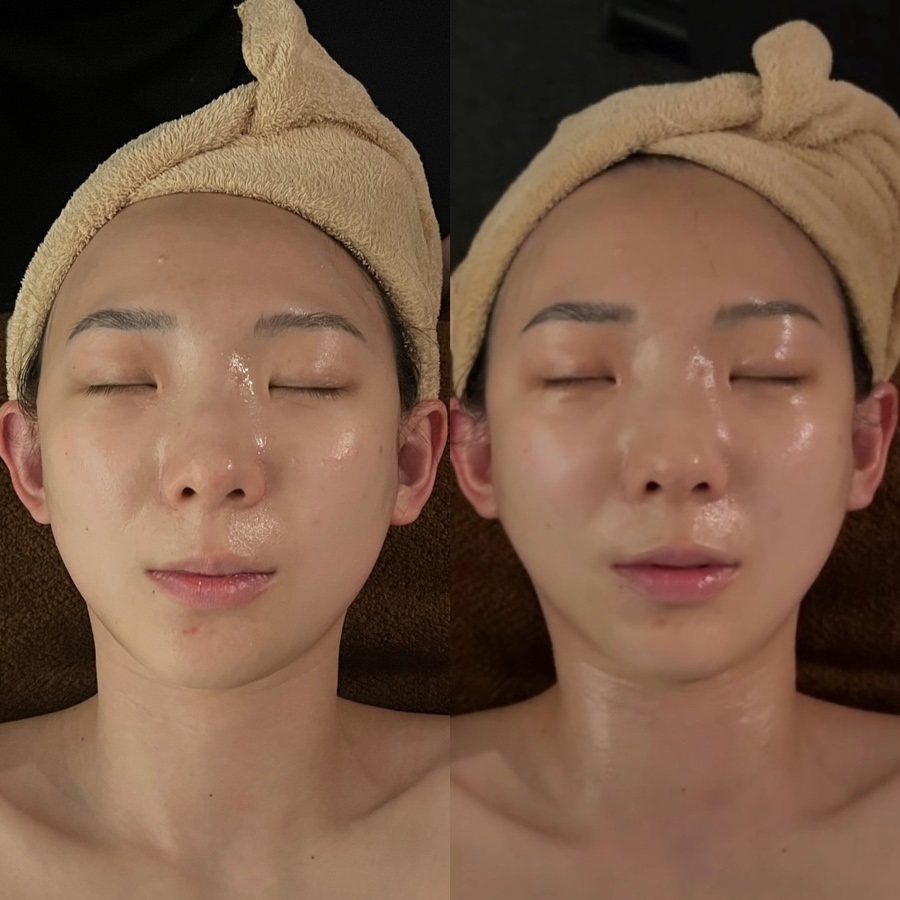 얼굴필라테스바이지 이미지