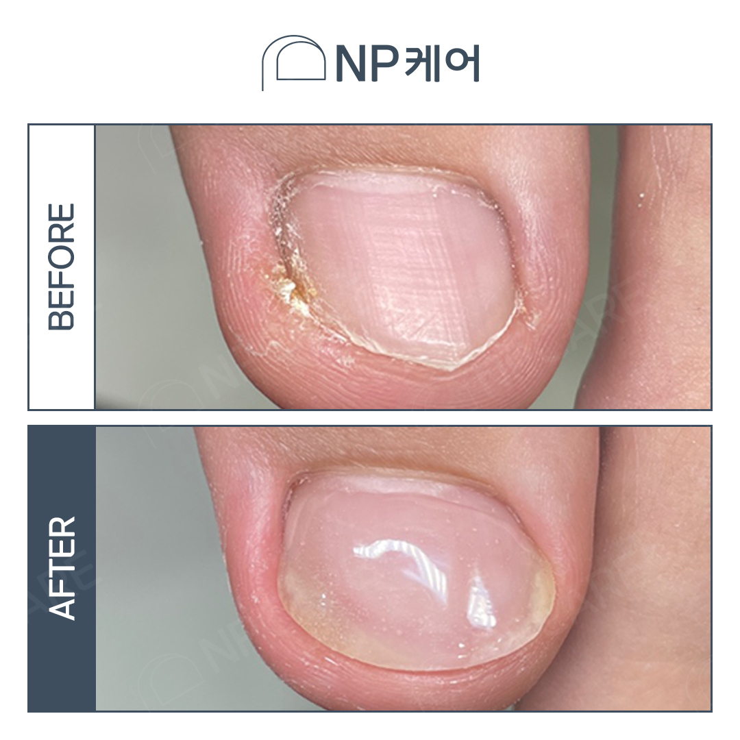 엔피케어 부산연산점