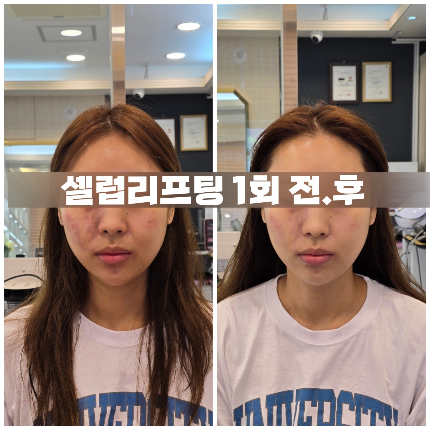 뷰티스토리 광주본점 photo 10
