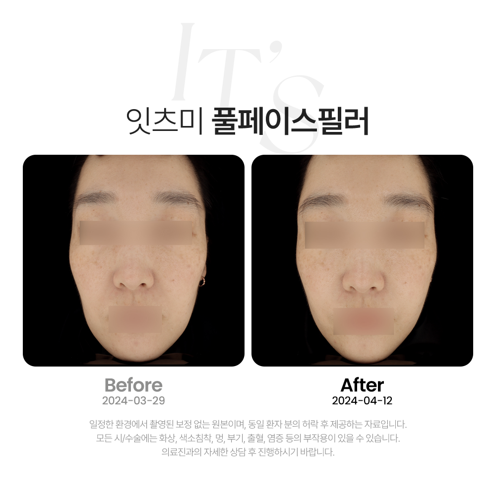 잇츠미의원 동탄