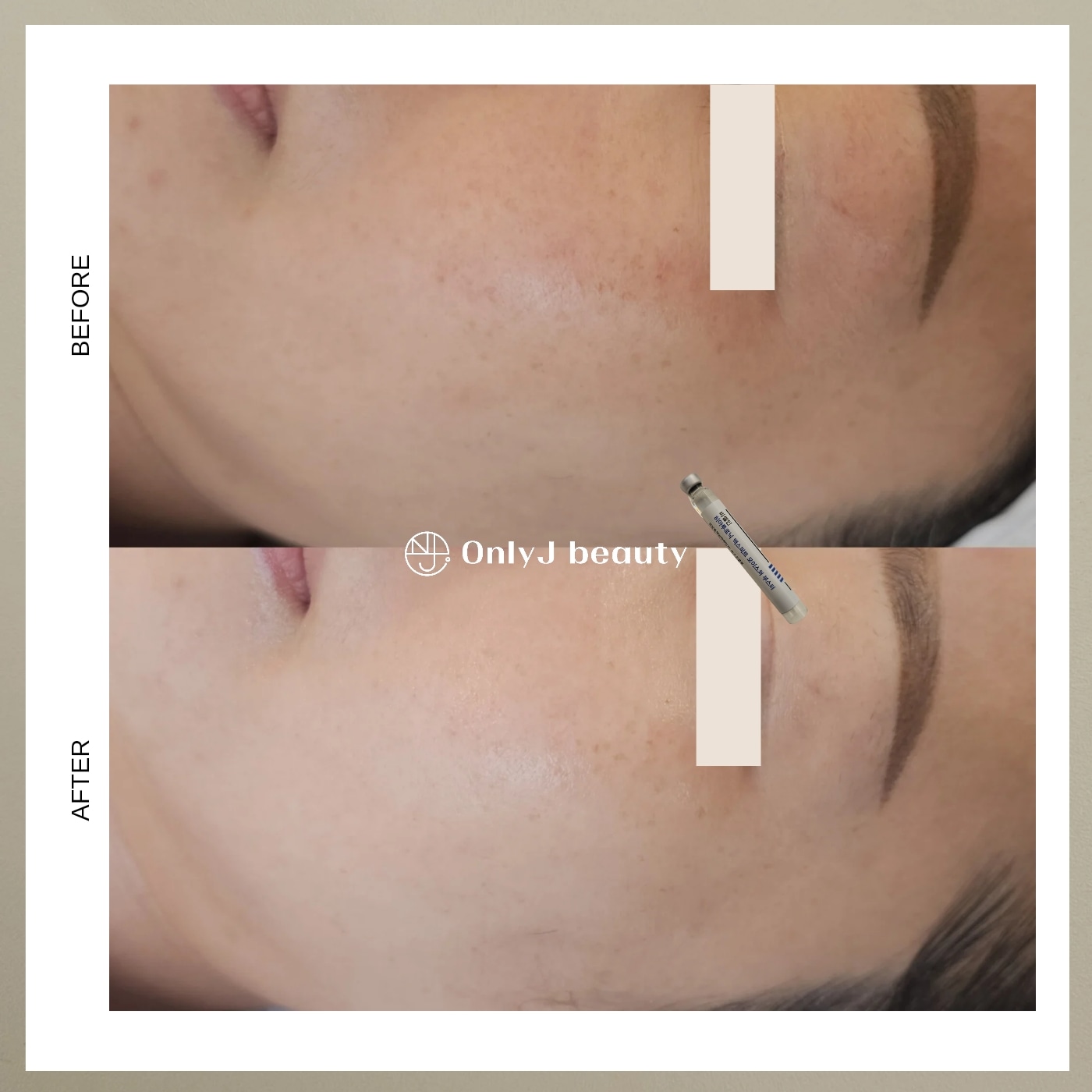 온리제이뷰티 대표 이미지