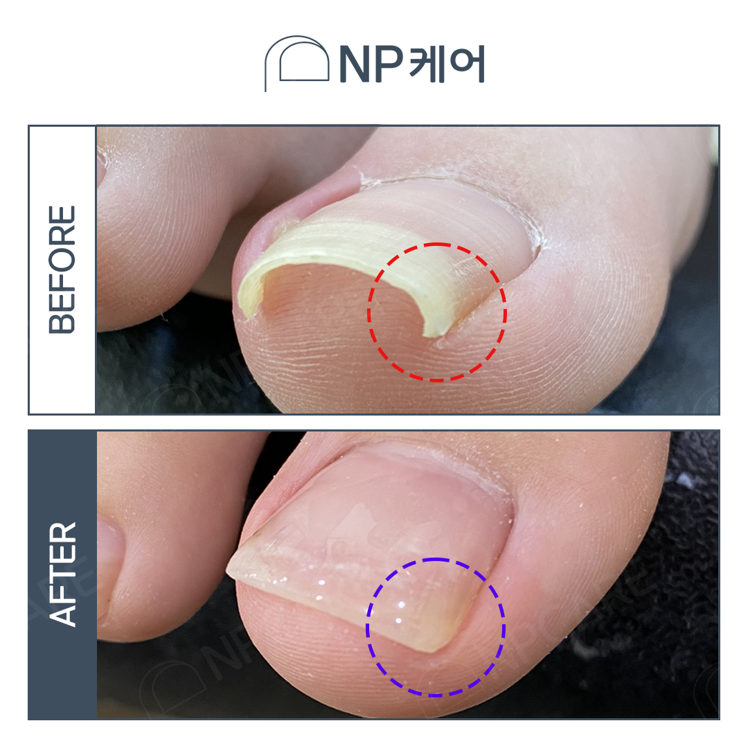 엔피케어 부산연산점