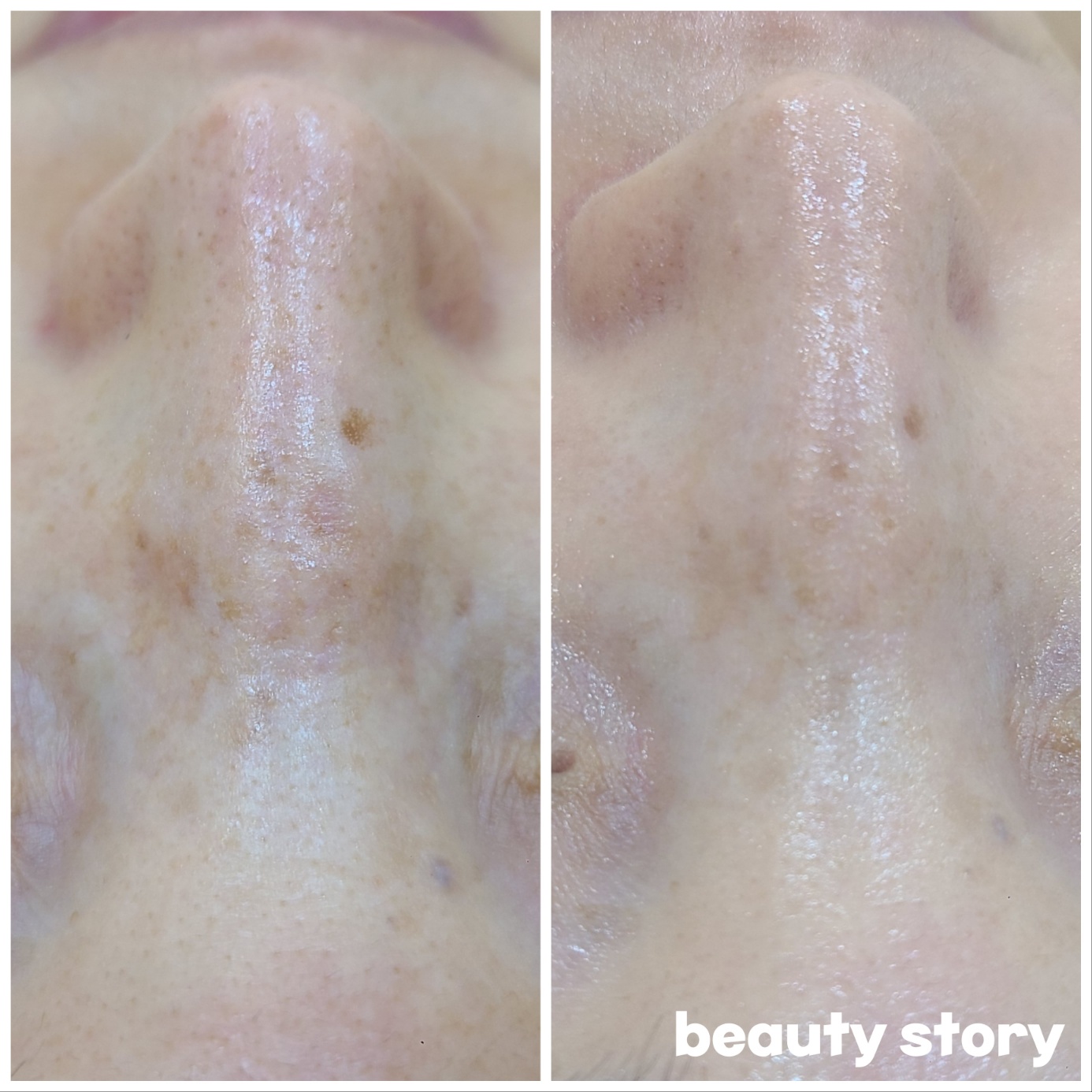 뷰티스토리 대표 이미지