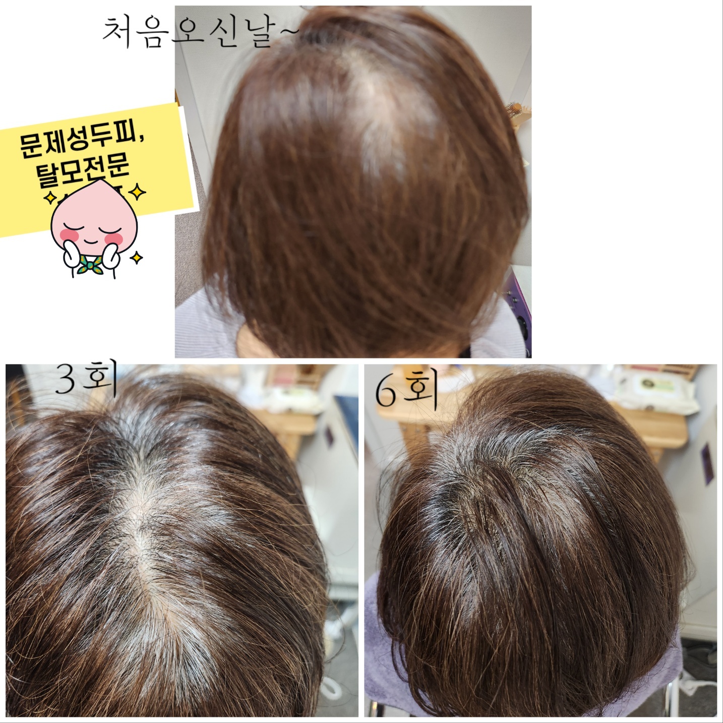 아그데