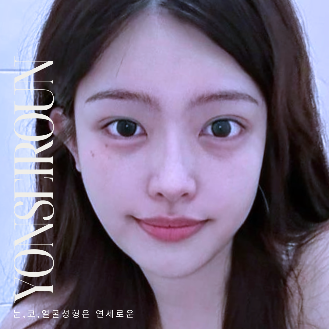 연세로운성형외과 대표 이미지