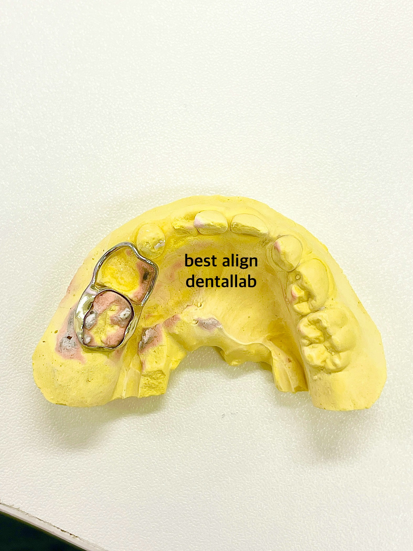 베스트얼라인치과기공소 대표 이미지