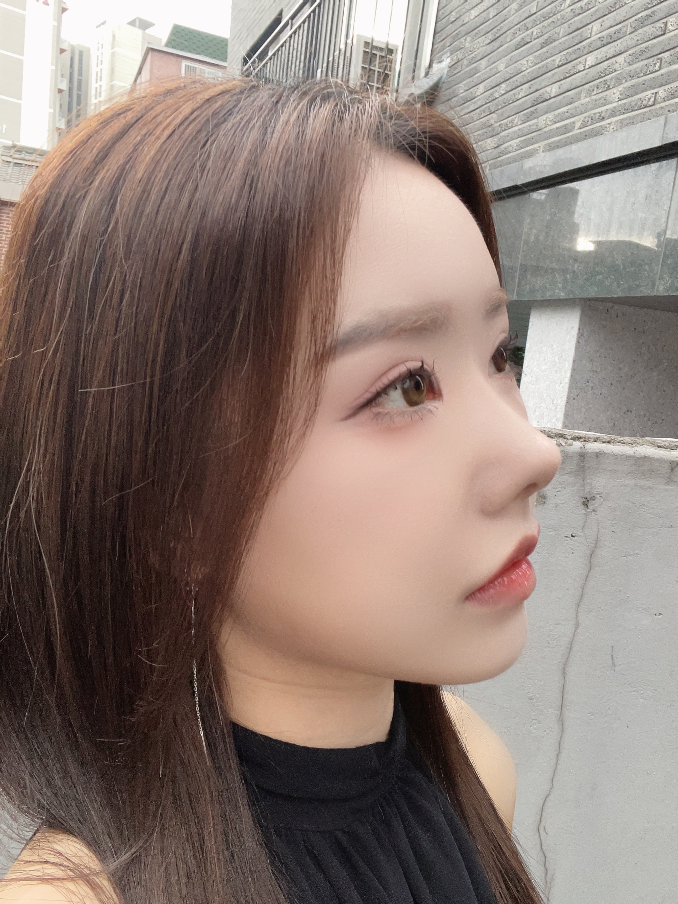 워나 성형외과의원 대표 이미지