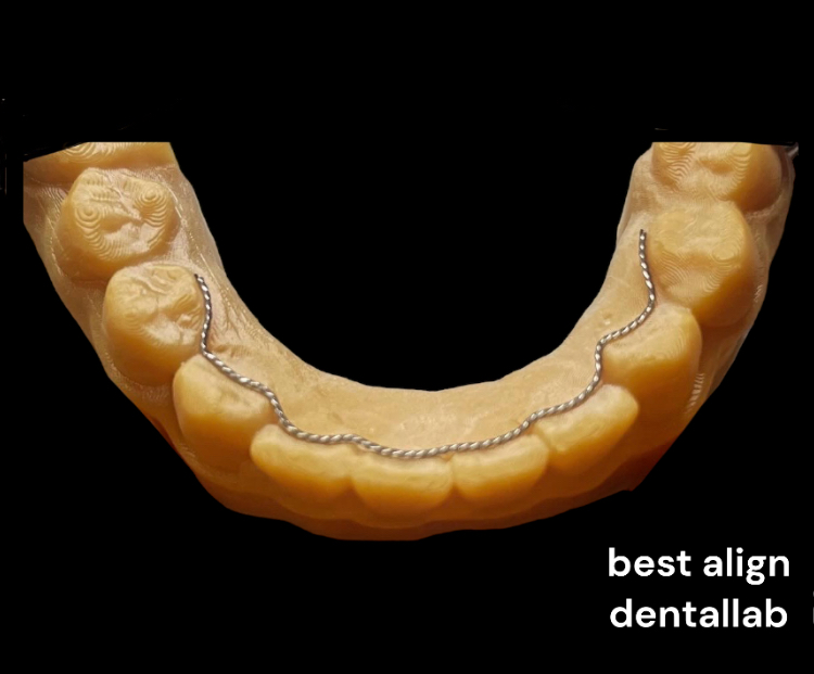 베스트얼라인치과기공소 대표 이미지