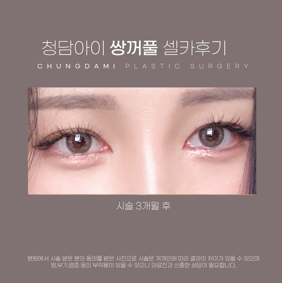 청담i성형외과의원 의정부점