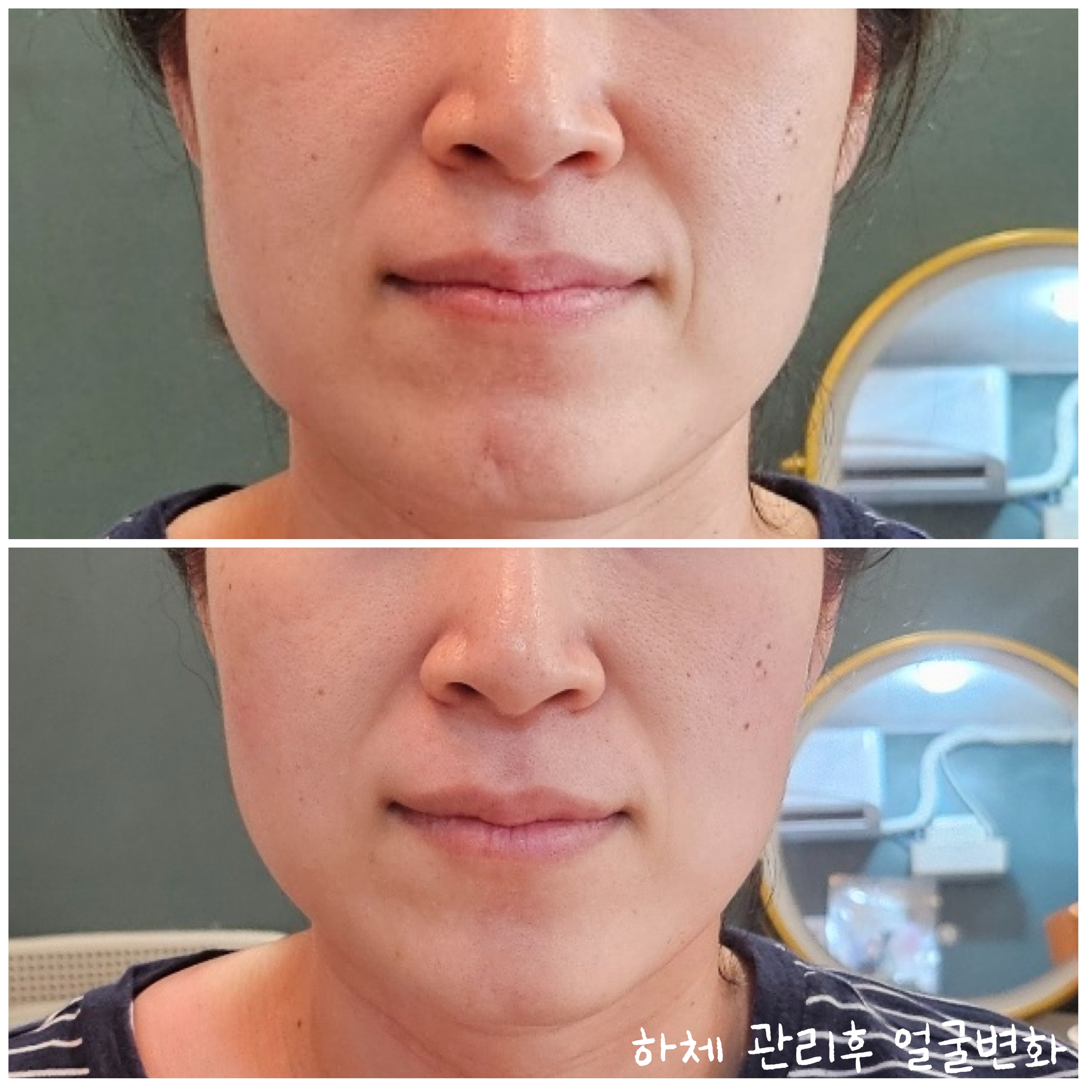 보니또 스킨앤바디