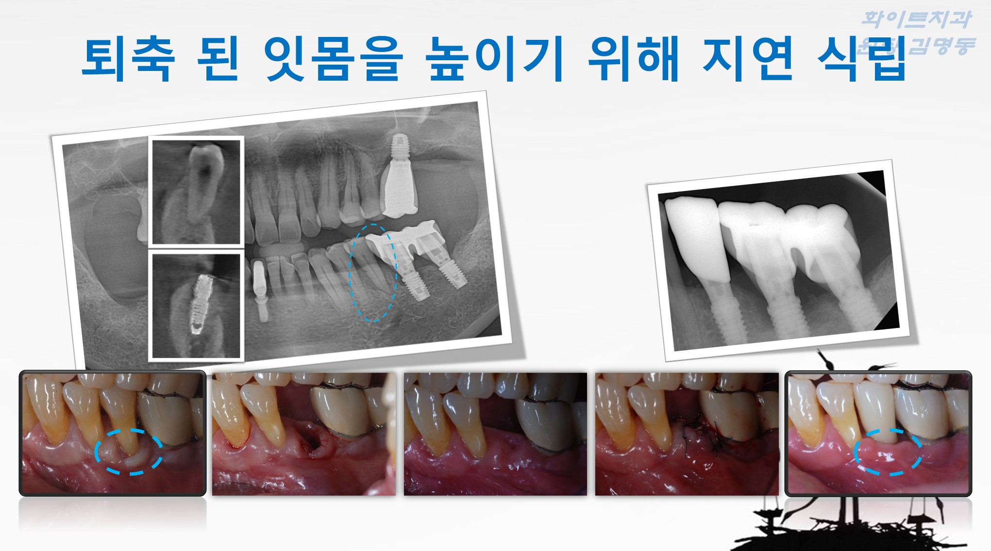 화이트치과의원