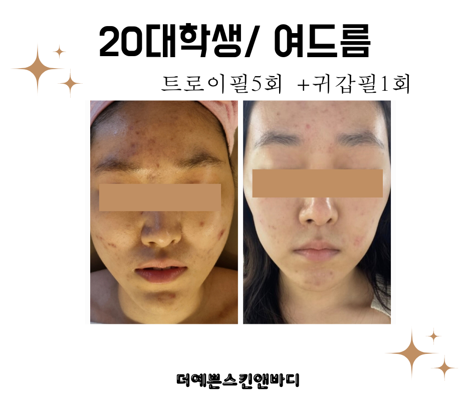 더예쁜스킨앤바디
