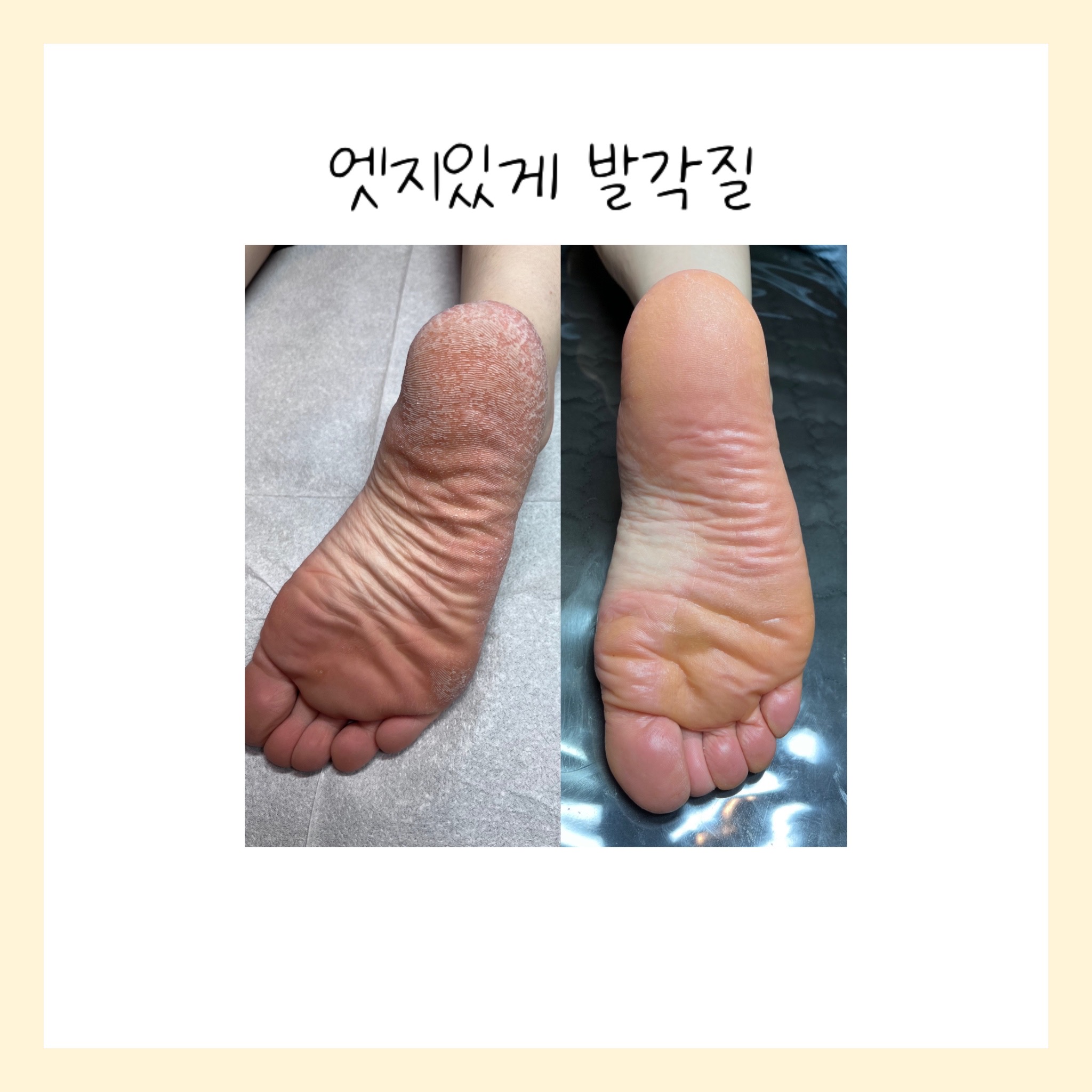 엣지있게 토탈뷰티샵