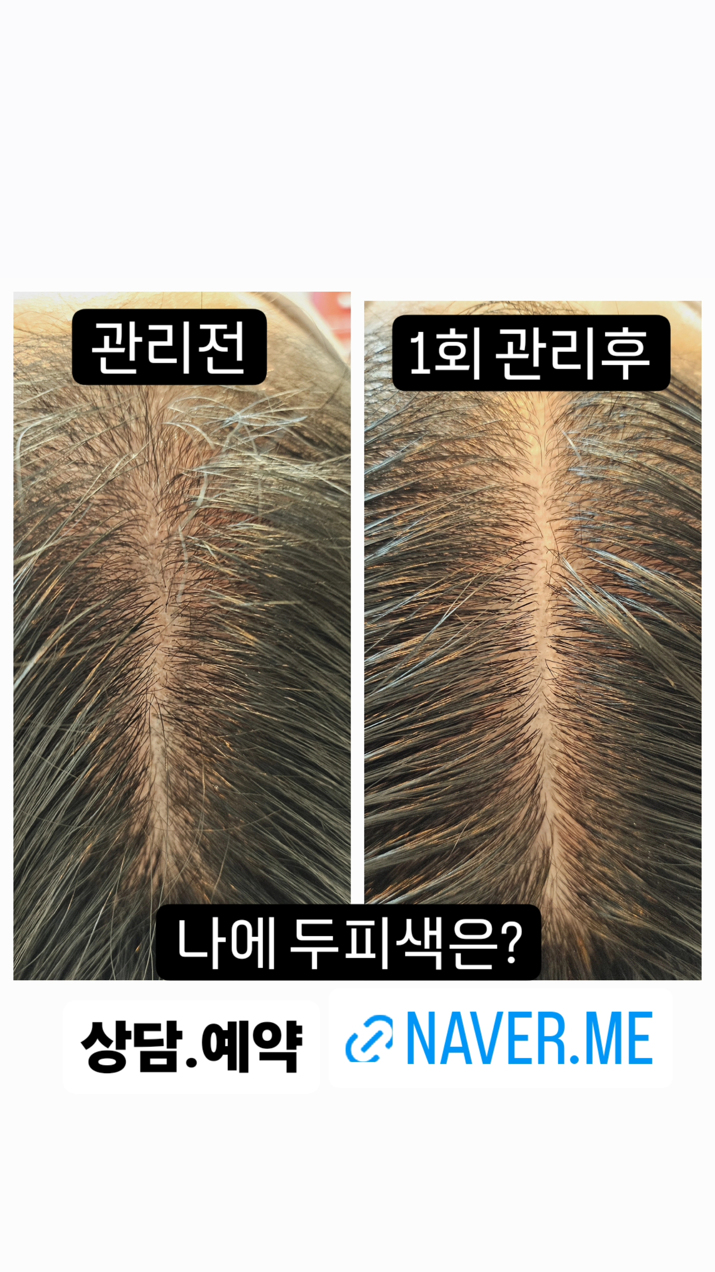 까망채움스칼프 대표 이미지