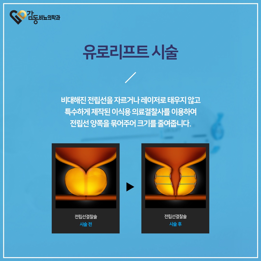 감동비뇨의학과의원 강남