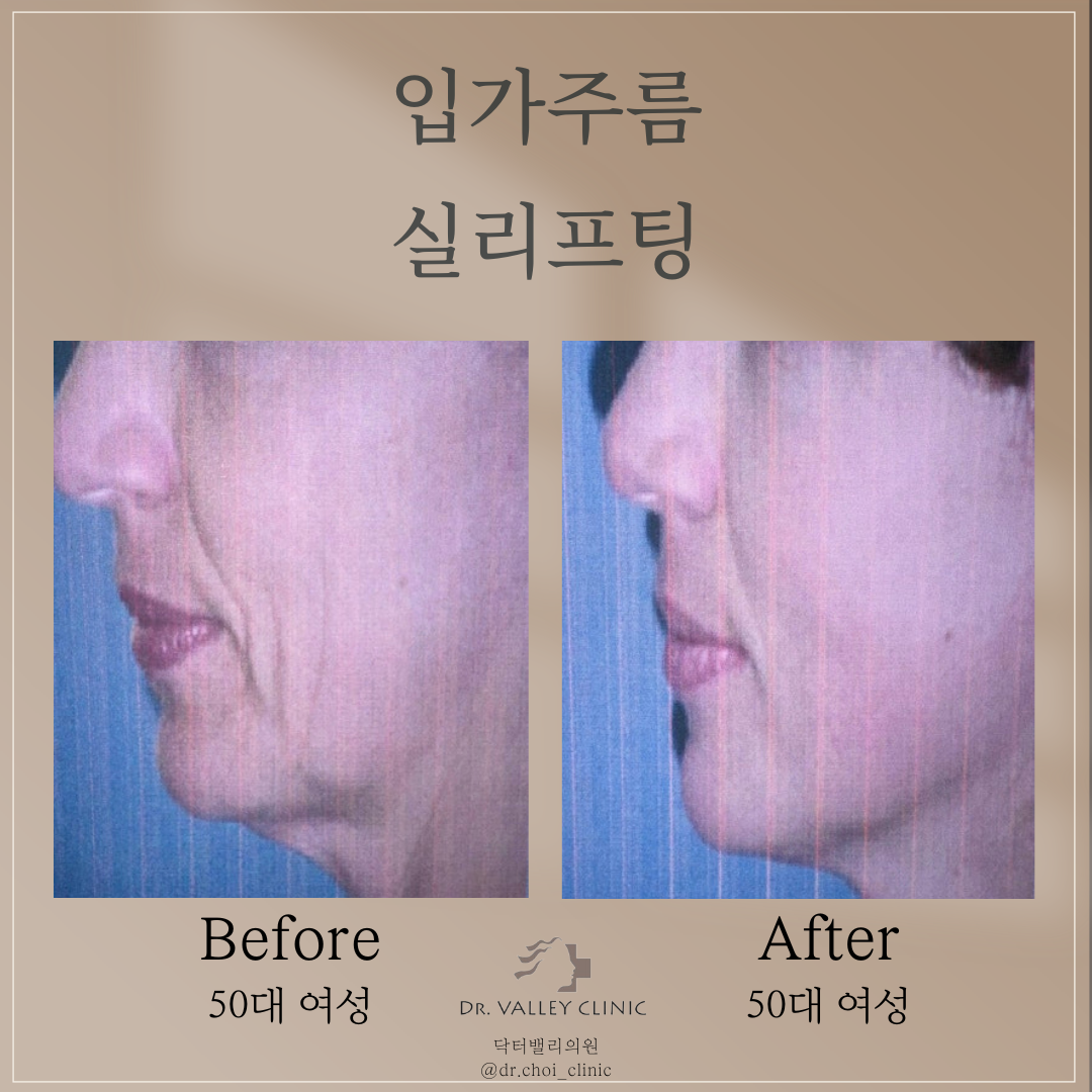 닥터밸리의원 대표 이미지