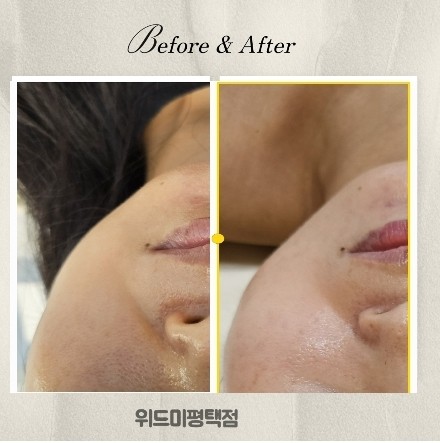 위드미 평택점
