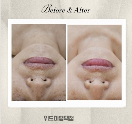 위드미 평택점