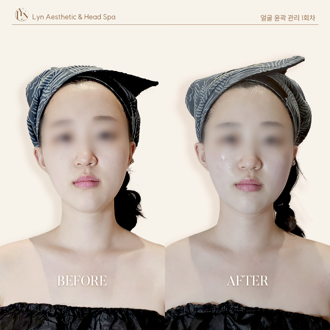 린에스테틱 대표 이미지