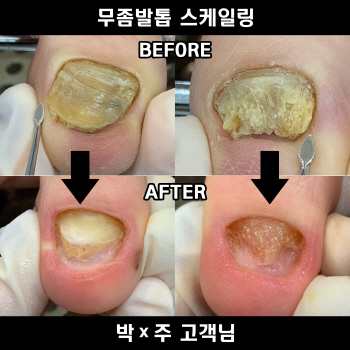 엘네일