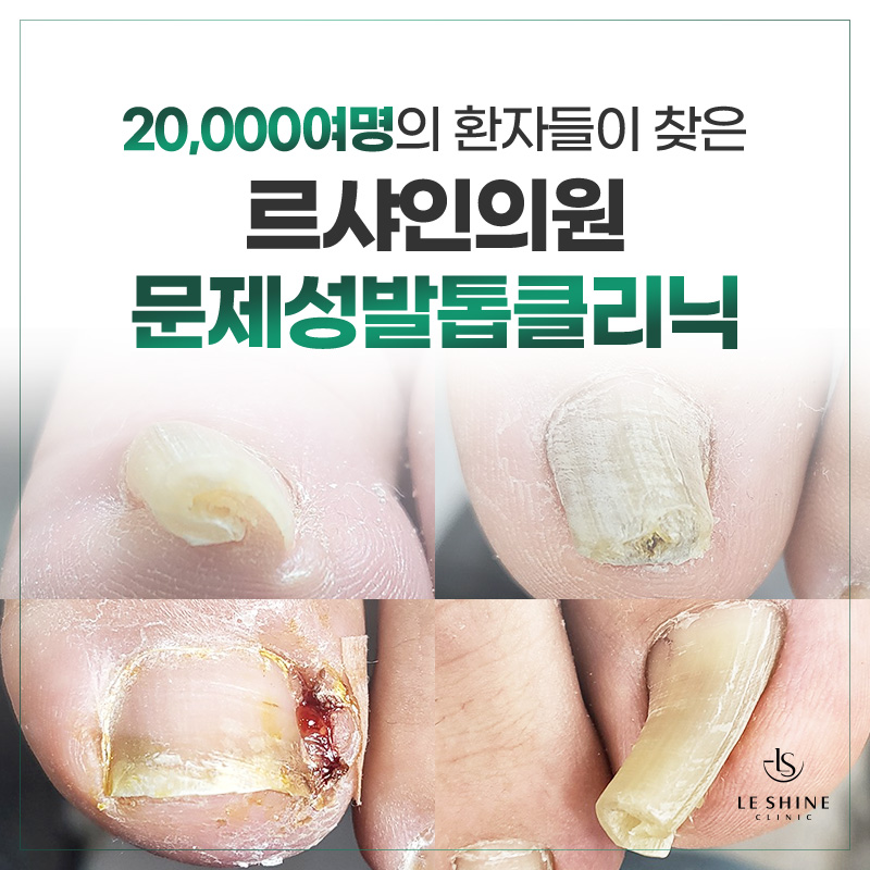 르샤인의원 문제성발톱클리닉 대표 이미지
