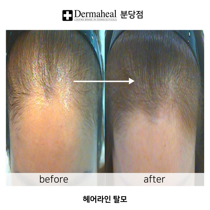 엠지에프두피탈모센터 분당야탑점 내부 이미지