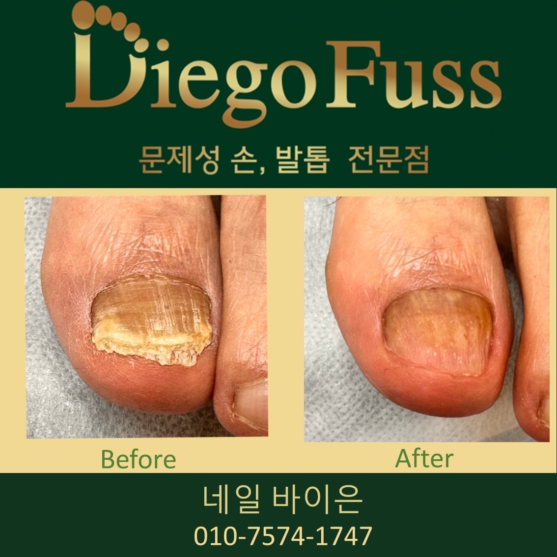 디에고푸스 연희점 네일바이은