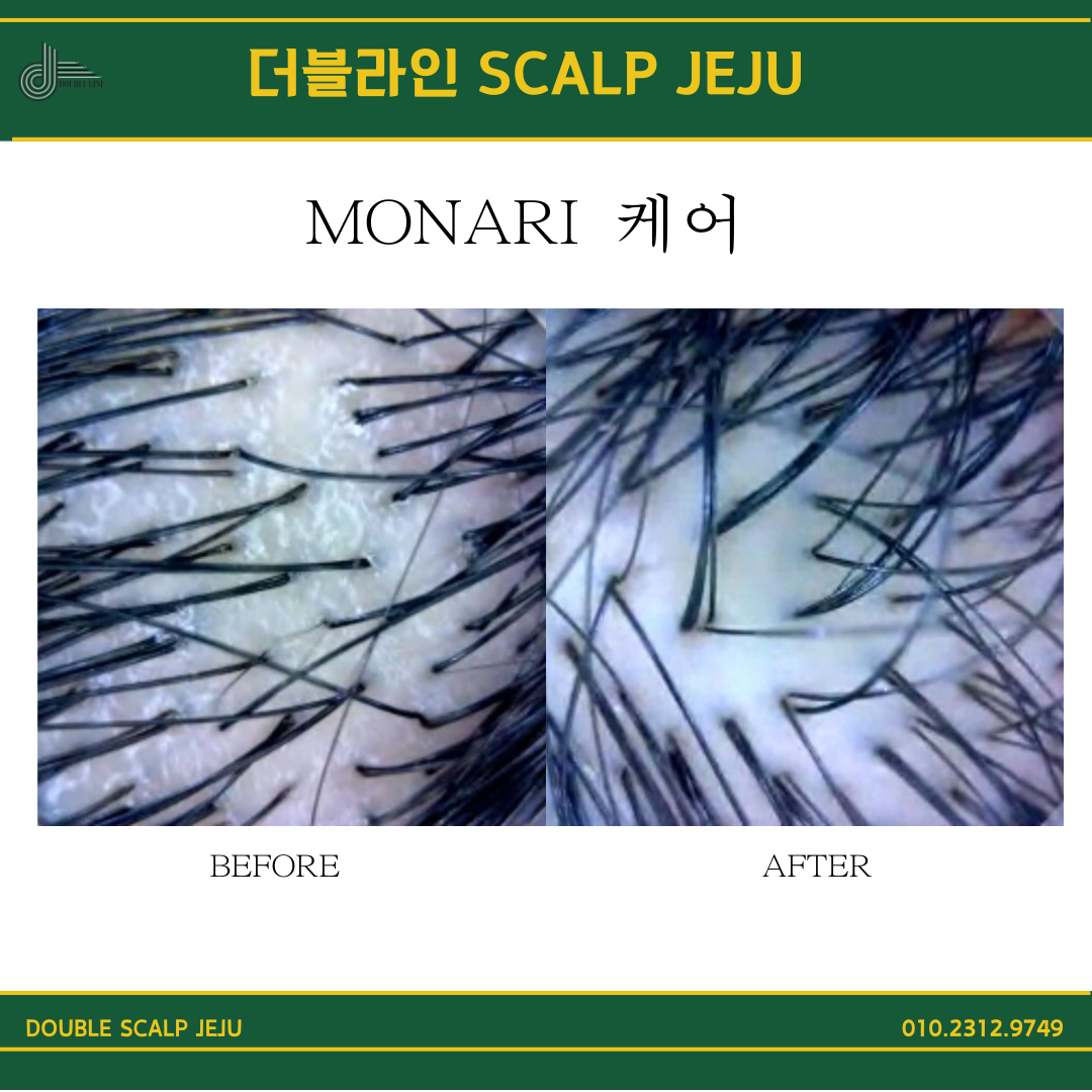 더블라인스칼프 제주점 photo 6
