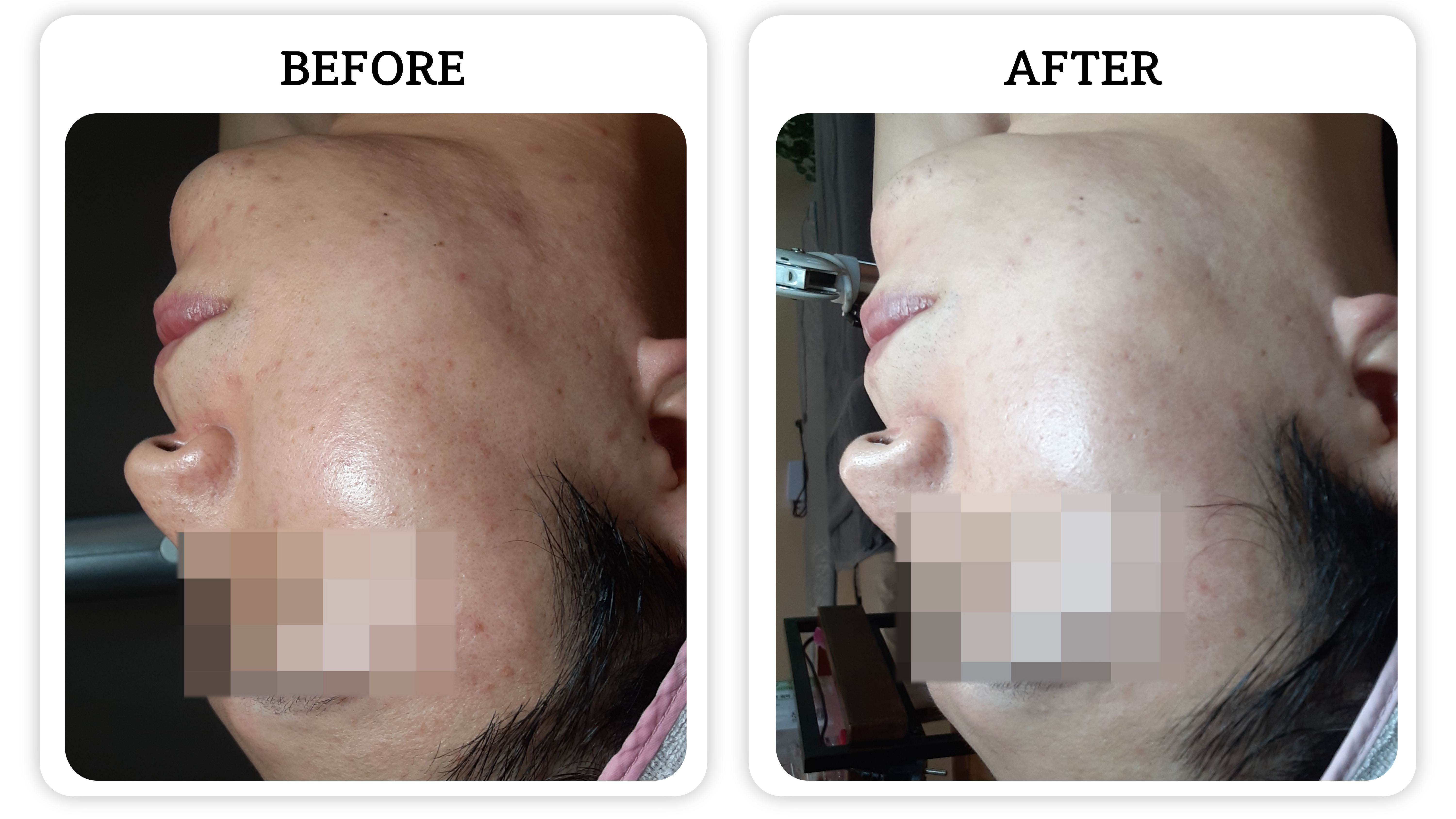 인포레스킨 대표 이미지