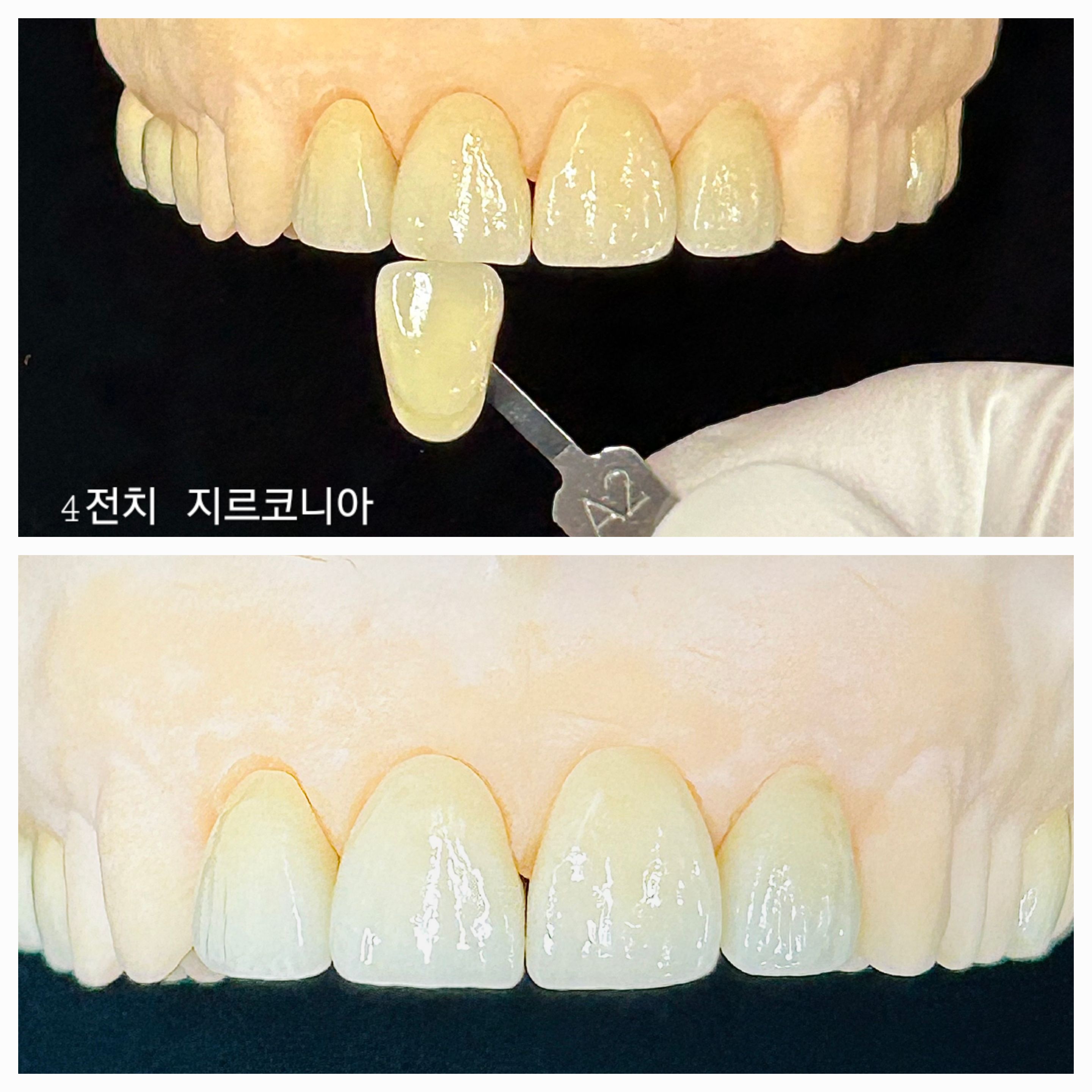 바라던치과기공소 대표 이미지