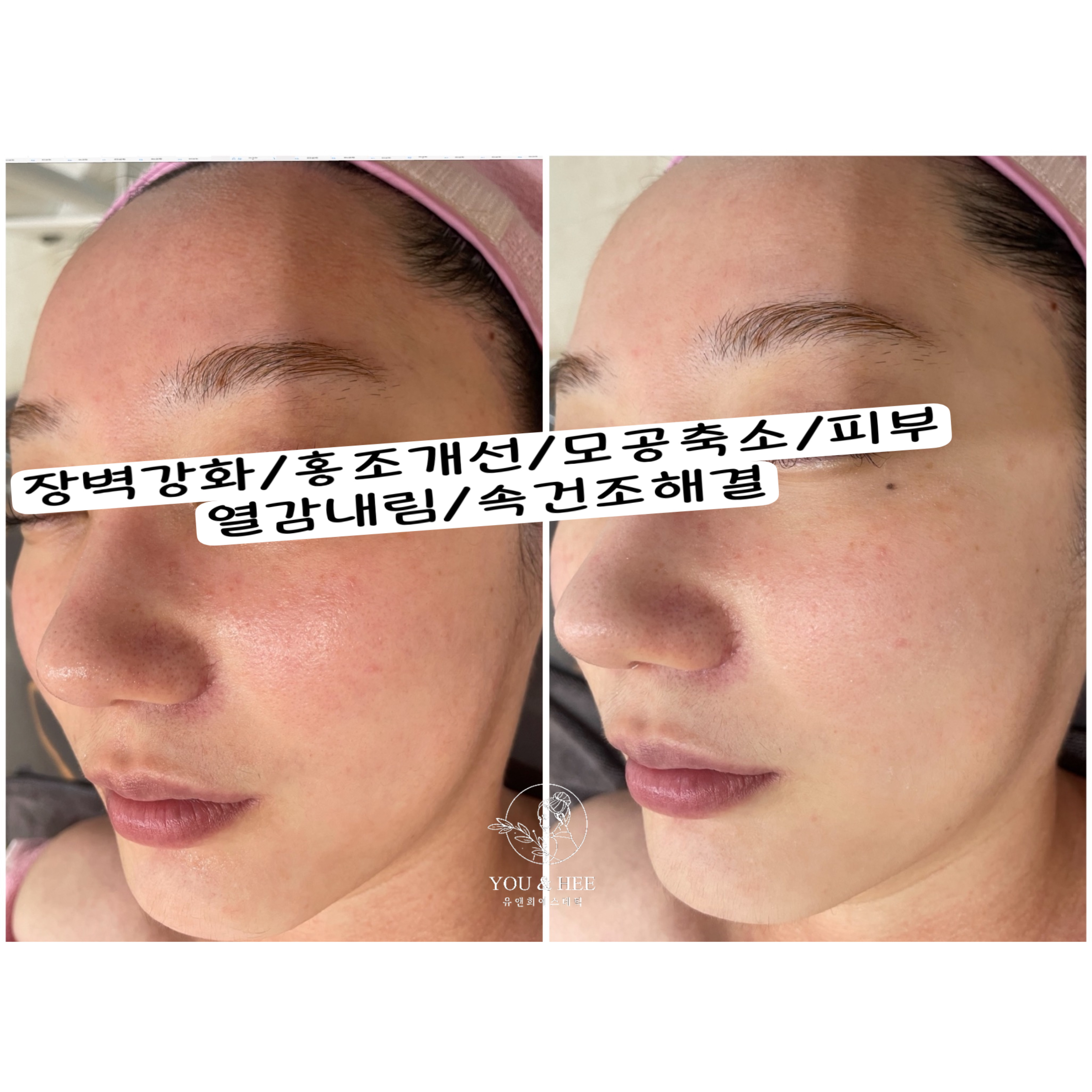 유앤희에스테틱 광주첨단점