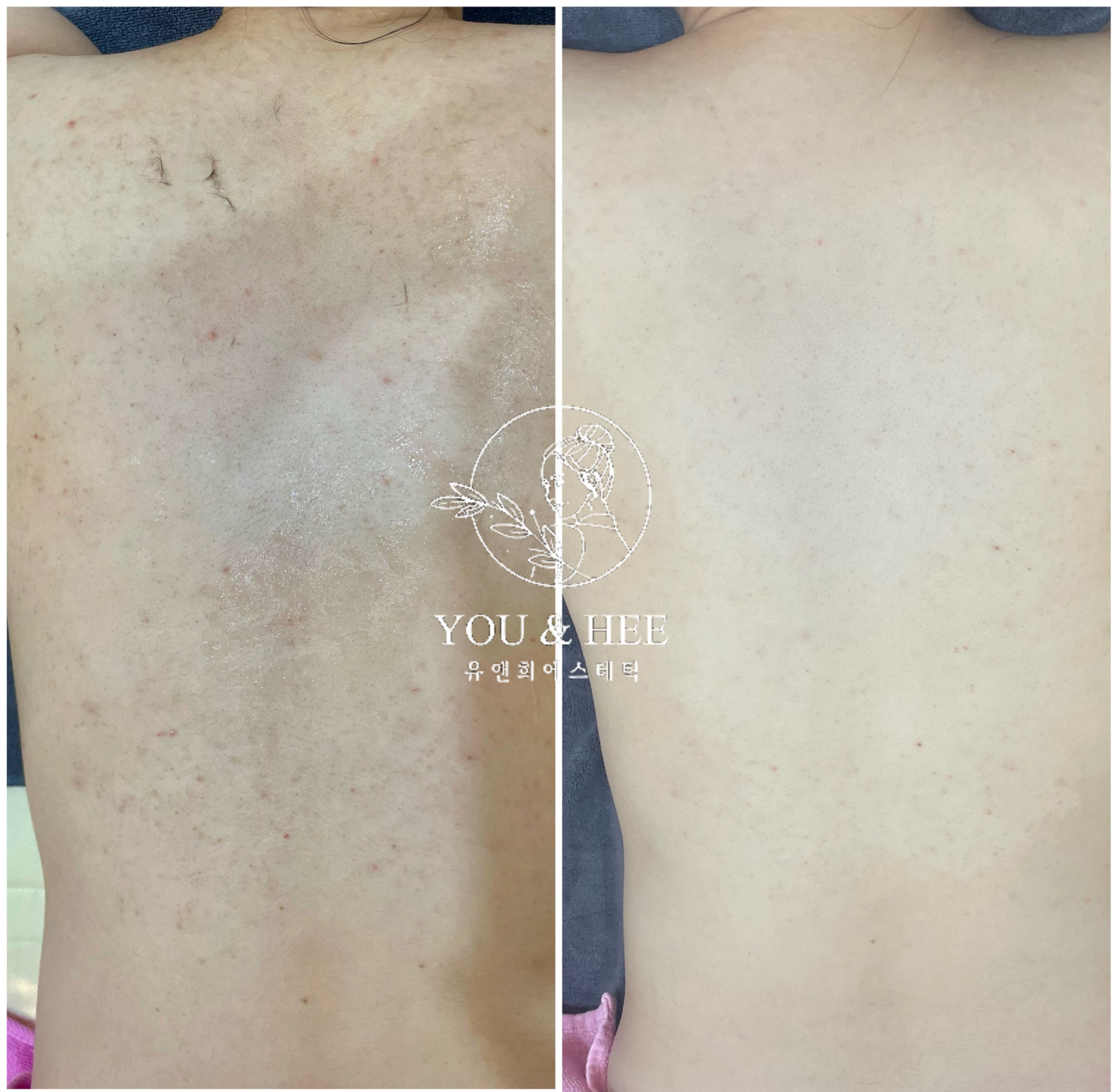 유앤희에스테틱 광주첨단점