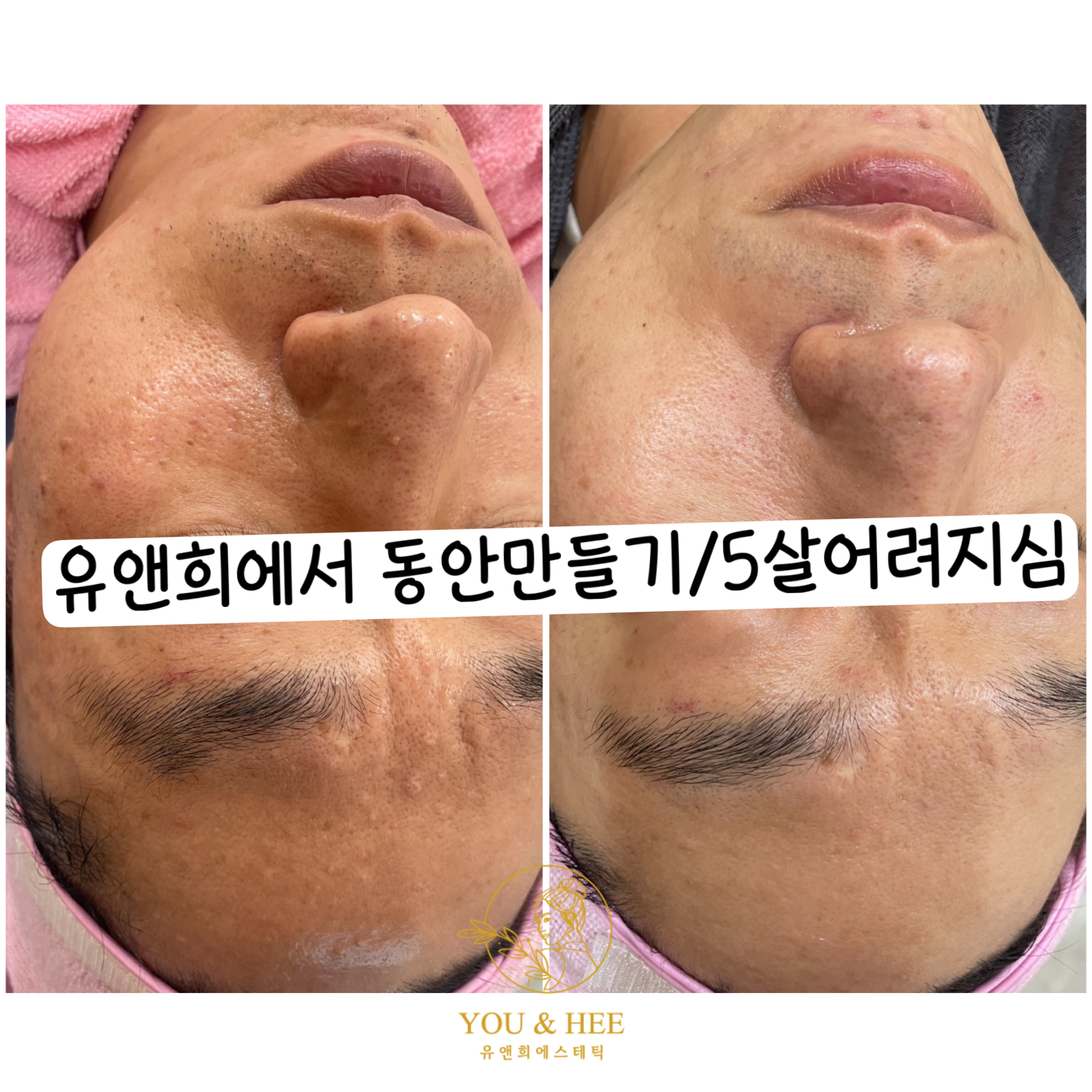 유앤희에스테틱 광주첨단점