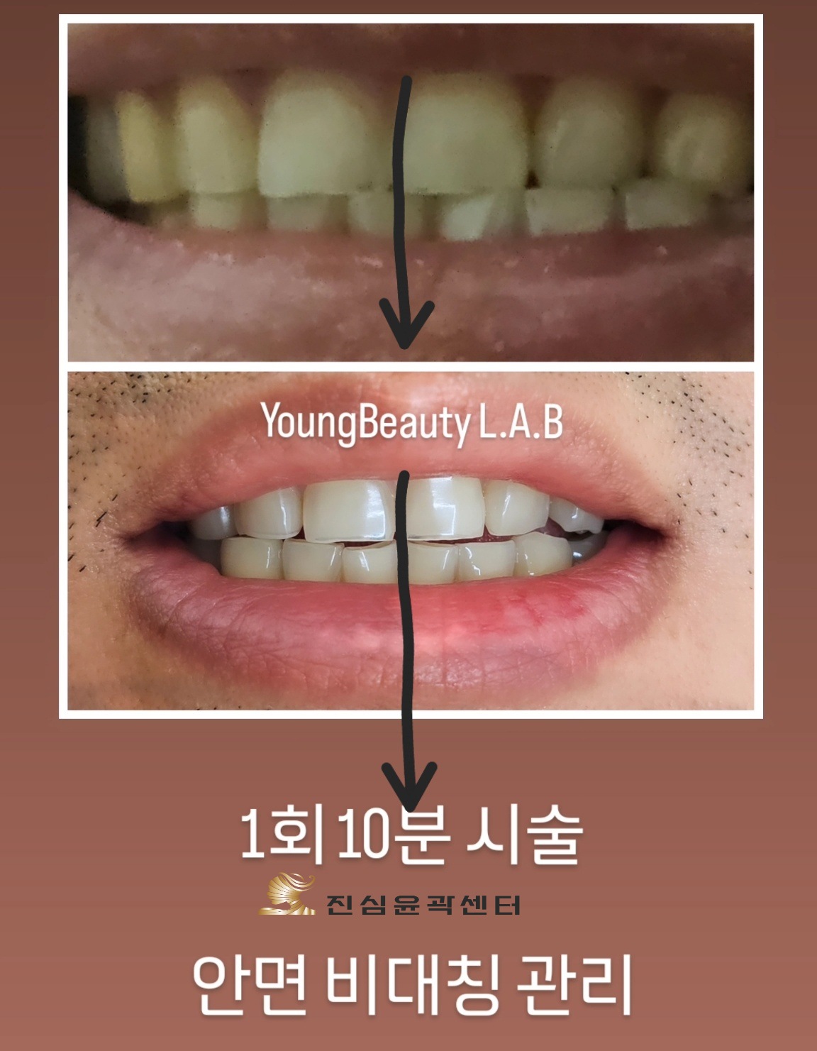 진심윤곽&탈모.건강센터 photo 9