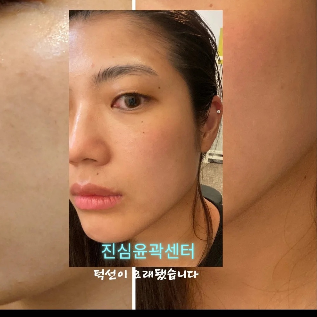 진심윤곽&탈모.건강센터 photo 5