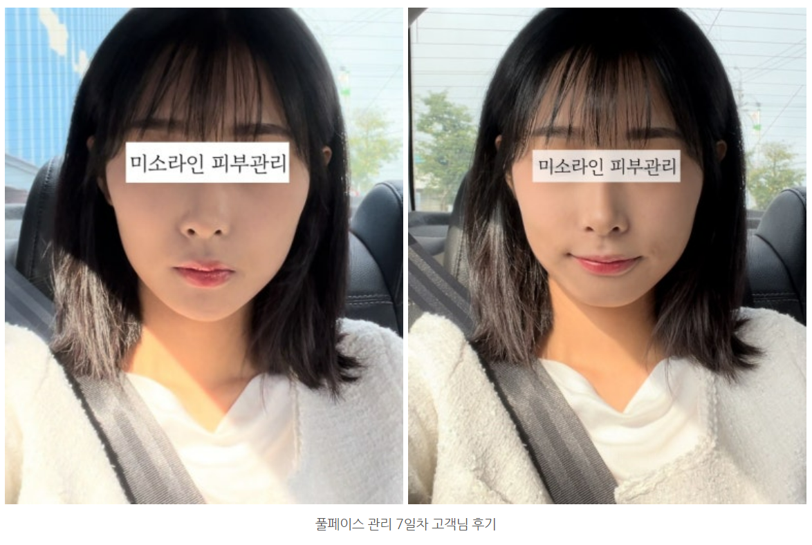 미소라인 피부관리