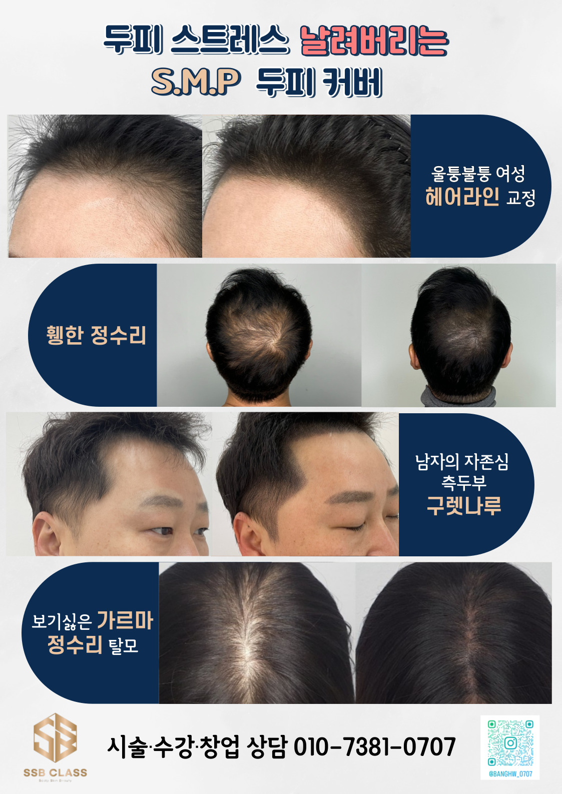 에스에스비클라스