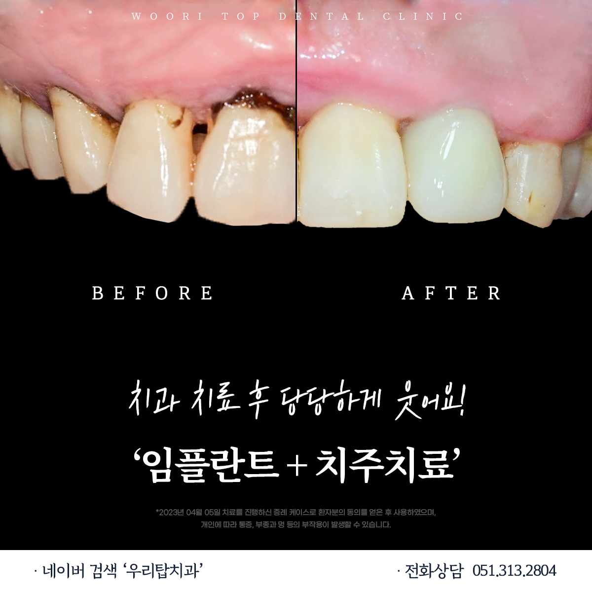 우리탑치과의원 대표 이미지