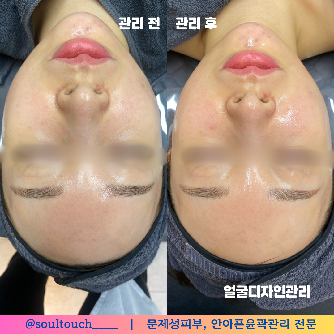 쏘울터치 부천피부관리 대표 이미지