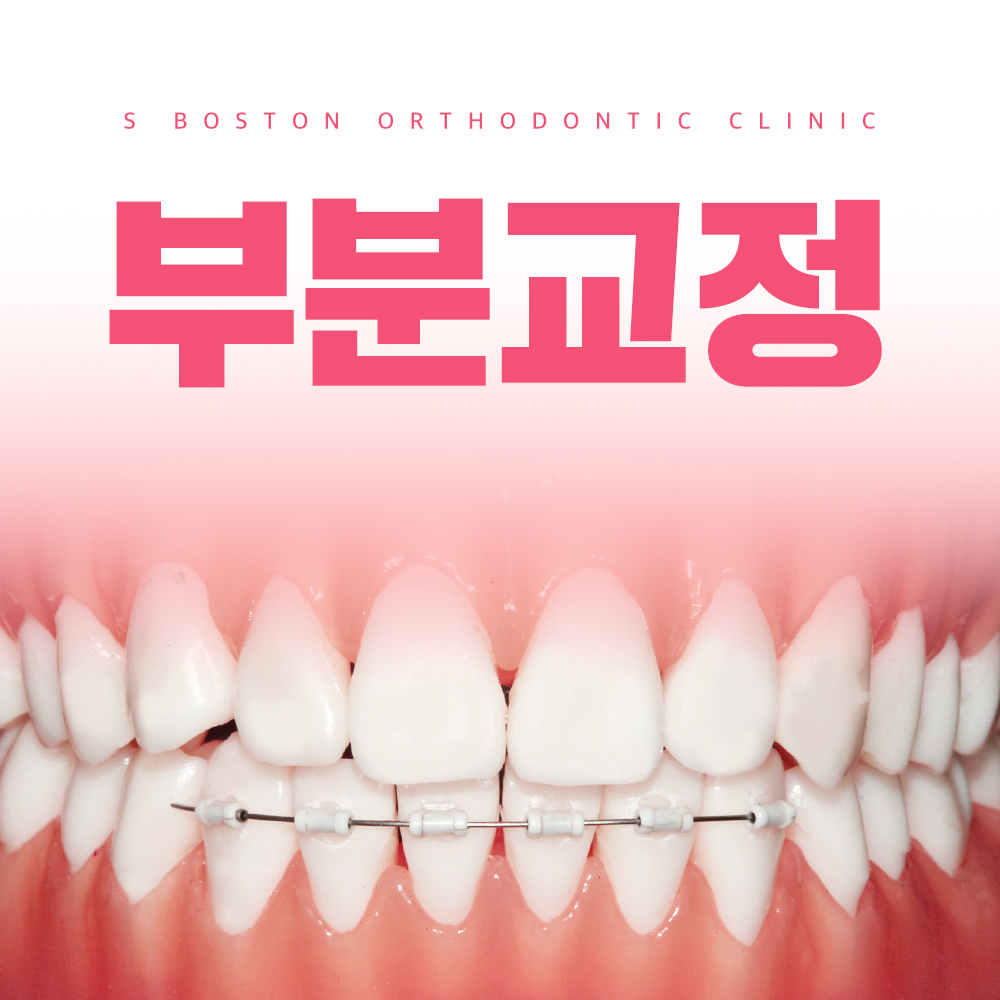 에스보스톤치과교정과치과의원
