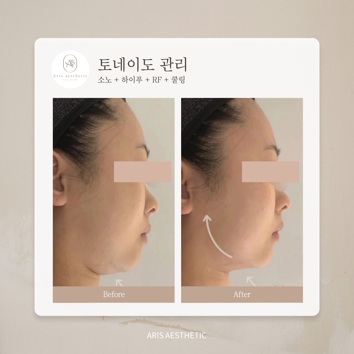 아리스 에스테틱 서면본점