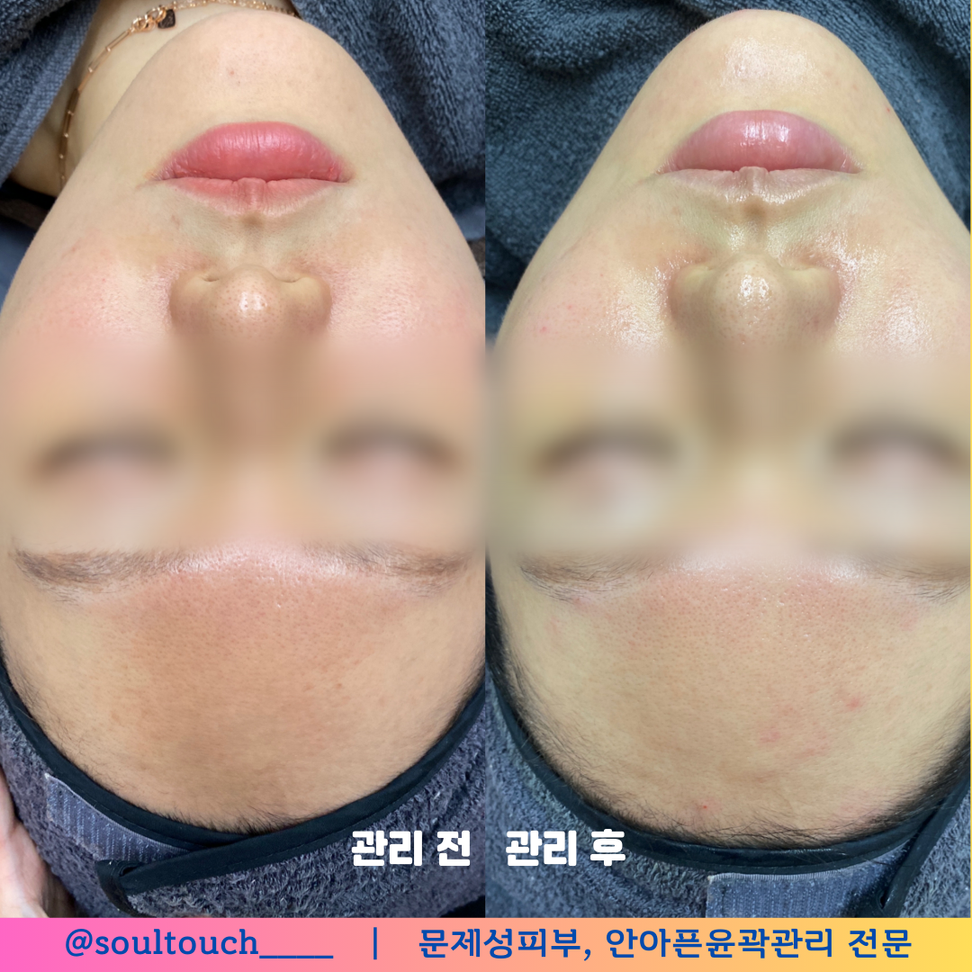 쏘울터치 부천피부관리 대표 이미지