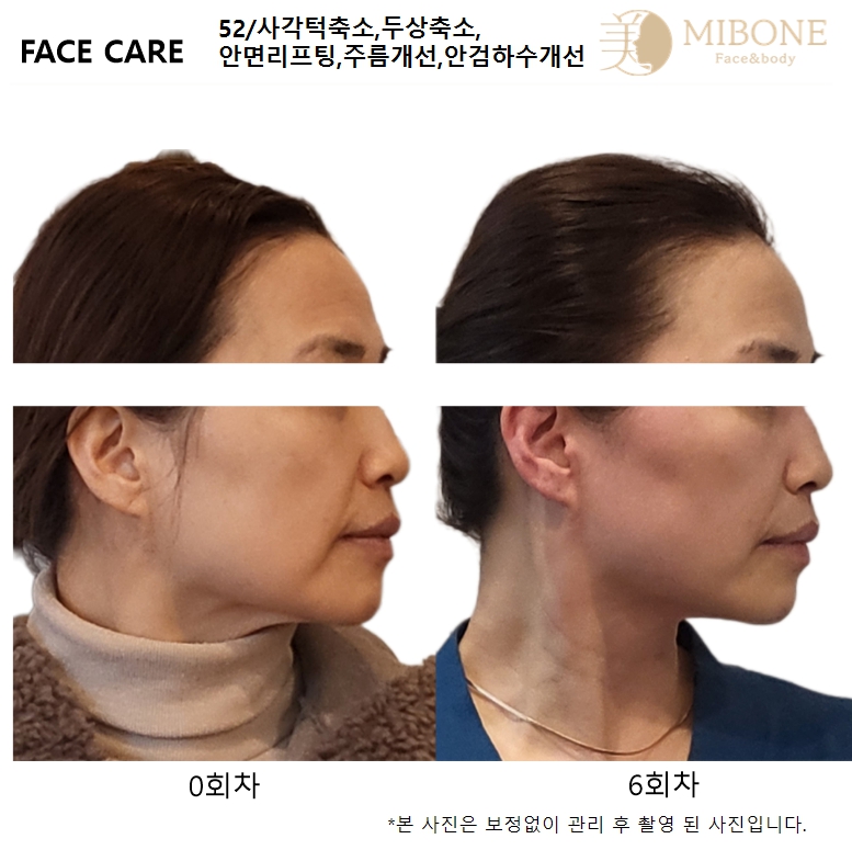 미본 얼굴윤곽관리 신촌점 대표 이미지