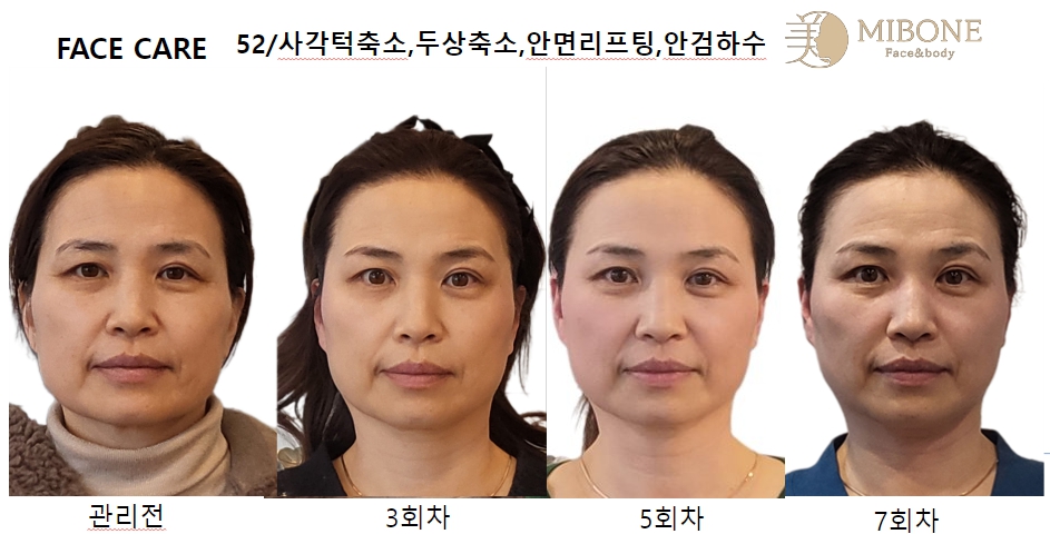 미본 얼굴윤곽관리 신촌점 대표 이미지