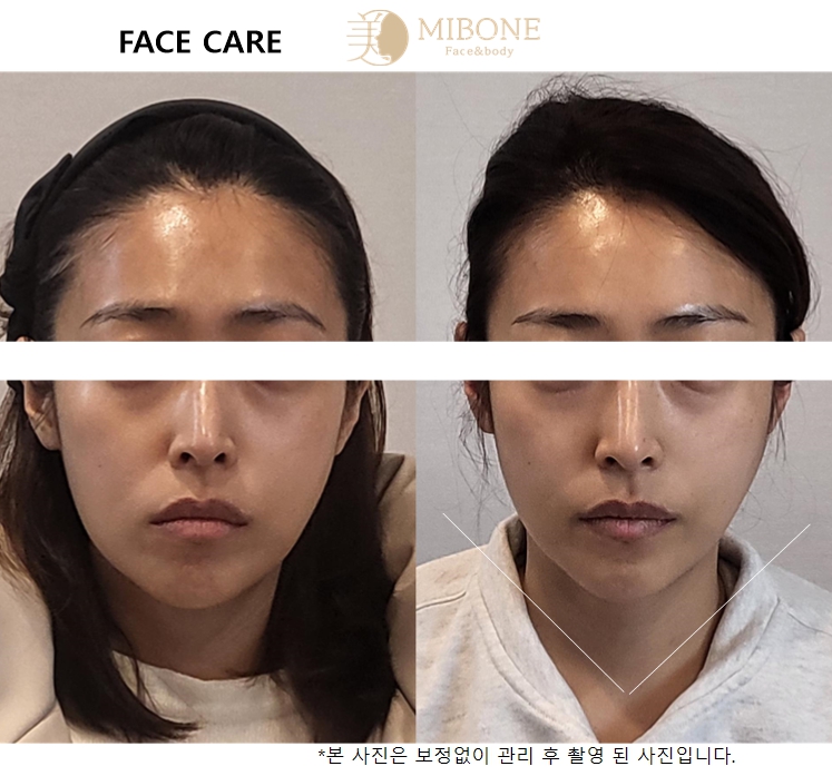 미본 얼굴윤곽관리 신촌점 대표 이미지