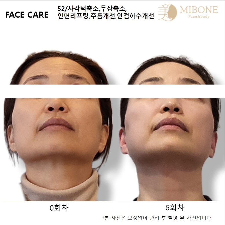미본 얼굴윤곽관리 신촌점 대표 이미지
